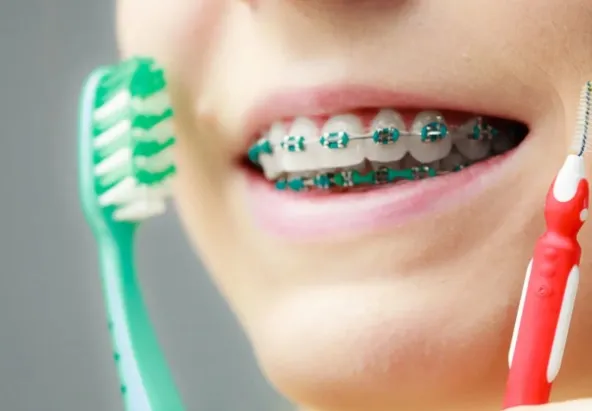 Jakie błędy w higienie jamy ustnej popełniają osoby noszące aparat?